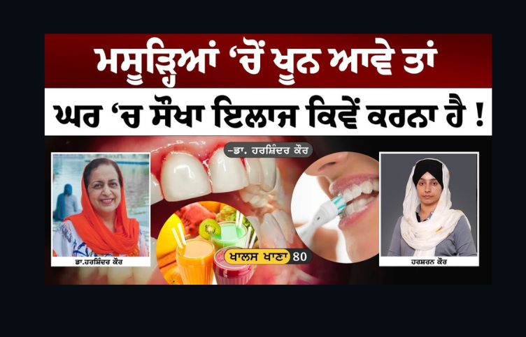 Treatment of bleeding gums । easy treatment at home । Dr Harshindar Kaur । KHALAS KHANA- 80